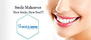 Smile Makeover / Smile Designing / Cosmetic Dentist services