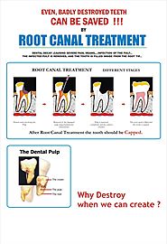 Root Canal Treatment/ Endodontic Therapy at Facets Dental Kochi