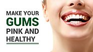 Gum Bleaching/ Gum Depigmentation/Gum Aesthetics