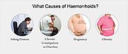 How to get best external haemorrhoids treatment Cape Town