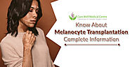 Know About Melanocyte Transplantation Complete Information | Blog Care Well Medical Centre