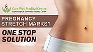 Looking to Get Rid of Pregnancy Stretch Marks? We'll Provide One Stop Solution