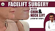 How to Facelift Surgery Done With Chin Lift & Neck Lift? (Step by Step)