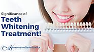 Significance of Teeth Whitening Treatment