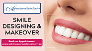 Smile Designing & Makeover - Ashton Avenue Dental Practice
