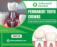 Durable Permanent Dental Crown Solutions