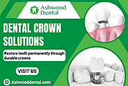 Upgrade Your Smile with Permanent Crowns