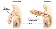 Male Sexual Dysfunction Treatment Chennai | Treatment for Erectile Dysfunction Tamil Nadu
