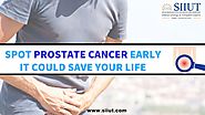 Treatment for Prostate Cancer Chennai | Signs and Symptoms of Prostate Cancer | Urologist Tamil Nadu