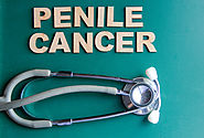 Penis Cancer Treatment in Chennai | Penile Cancer Surgery Tamil Nadu