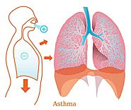 Asthma attack | Best asthma remedy guidelines - newhopepsychology