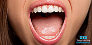 Website at https://topnovaorthodontics.com/why-is-my-mouth-dry/