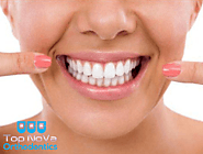Different Methods of Teeth Whitening You Should Know