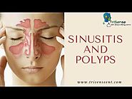 Sinusitis and Polyps