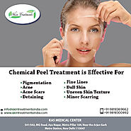 Chemical Peel Treatment in Aya Nagar Delhi