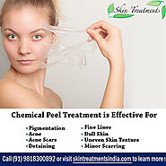 Chemical Peels Treatment Cost in Delhi - Skin Treatment Clinic Delhi