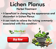 Lichen Planus Herbal Treatment, Symptoms and Causes - Herbal Care Products