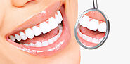 How Porcelain veneers Melbourne pro can help you with an immaculate smile?