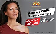 Website at https://www.ayurvedacoursesindia.com/vitiligo