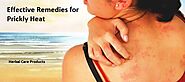 Effective Remedies for Prickly Heat That Work - Herbal Care Products