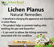 8 Home Remedies To Get Rid Of Lichen Planus | Natural Health News