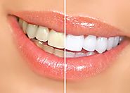 Cosmetic Dentistry Newcastle