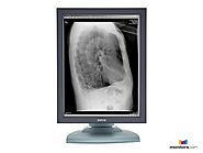 Barco® Nio MDNG-2121 2MP Grayscale Medical Diagnostic Radiology Monitor
