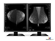New 5MP Eizo Radiforce Pair Mammography Monitor - GX550