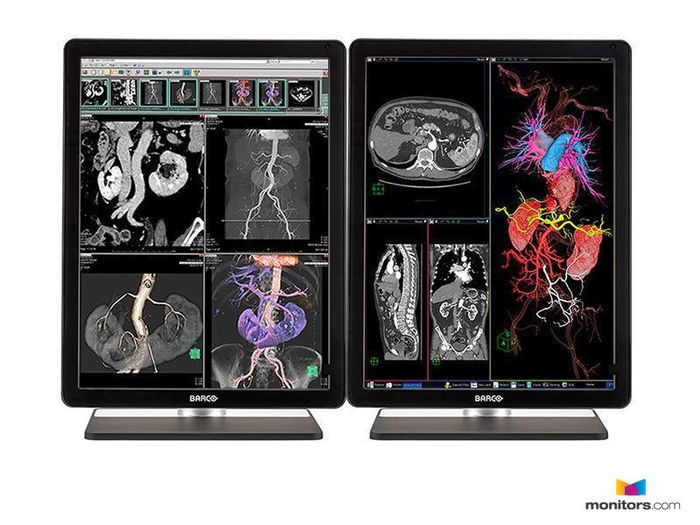 Diagnostic Radiology Monitors A Listly List