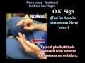 Nerve Injury, Positions Of The Hand - Everything You Need To Know - Dr. Nabil Ebraheim