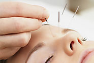 Anchor Acupuncture