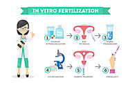 Website at https://www.arcivf.com/services/ivf-invitro-fertilization