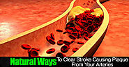 Arteries Foods : Foods That Naturally Unclog Arteries That Will Shock You!
