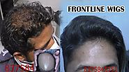 How to get best frontline with Men Wigs & Hair Wigs for Men in Delhi India | 9899746489