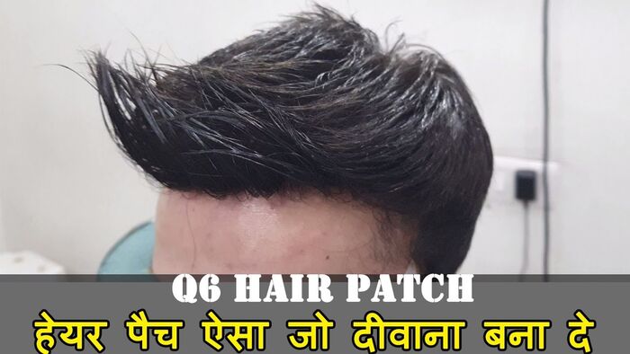 Delhis Top Hair Patch Fixing Service9873152223 Delhi Hair Fixing Photo  Slideshow  free to download  id 913e5bYTMzN