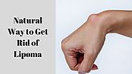 Natural Way to Get Rid of Lipoma