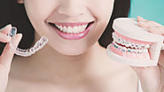 Buy Teeth Retainer Online at 50% Off in Cincinnati