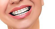 Buy Cheap Dentures Online in Cincinnati