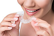 Make Your Smile Beautiful with Clear Reatiner in Oklahoma City