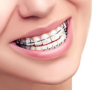 Find and Experienced Orthodontist in Houston