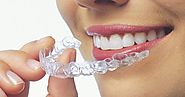 Shop Clear Aligners Online in Grand Rapids at 50% Off!