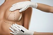 Here's What No One Tells You About Breast Lift Techniques