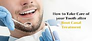 How to Take Care of your Tooth after Root Canal Treatment? | Dental Sphere The Expert Advantage