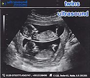 An ultrasound scan is the only way to... - Ultrasound Dimensions | Facebook
