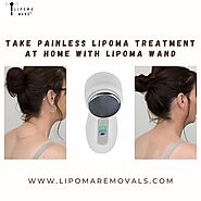 Take Painless Lipoma Treatment at Home with Lipoma Wand