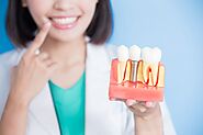 The Advantages Of A Single Tooth Implant In Surrey