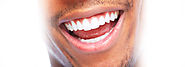 Laser teeth whitening Melbourne: what advantages does it have?