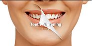 What facts a teeth Whitening Melbourne expert can tell about tooth whitening?