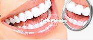 Teeth Whitening Melbourne: Reason to Get treatment for a better smile