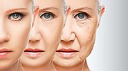 7 Effective Treatment To Get Rid Of Wrinkles: skination1 — LiveJournal